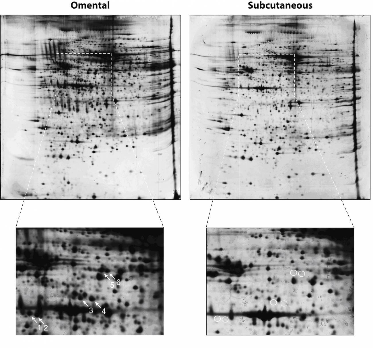 Analizan por primera vez la expresión de proteínas entre los dos tipos de grasa del cuerpo humano