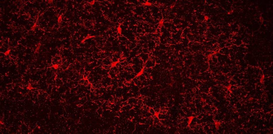  Antiinflamatorios para mejorar los problemas cognitivos por la abstinencia de la nicotina