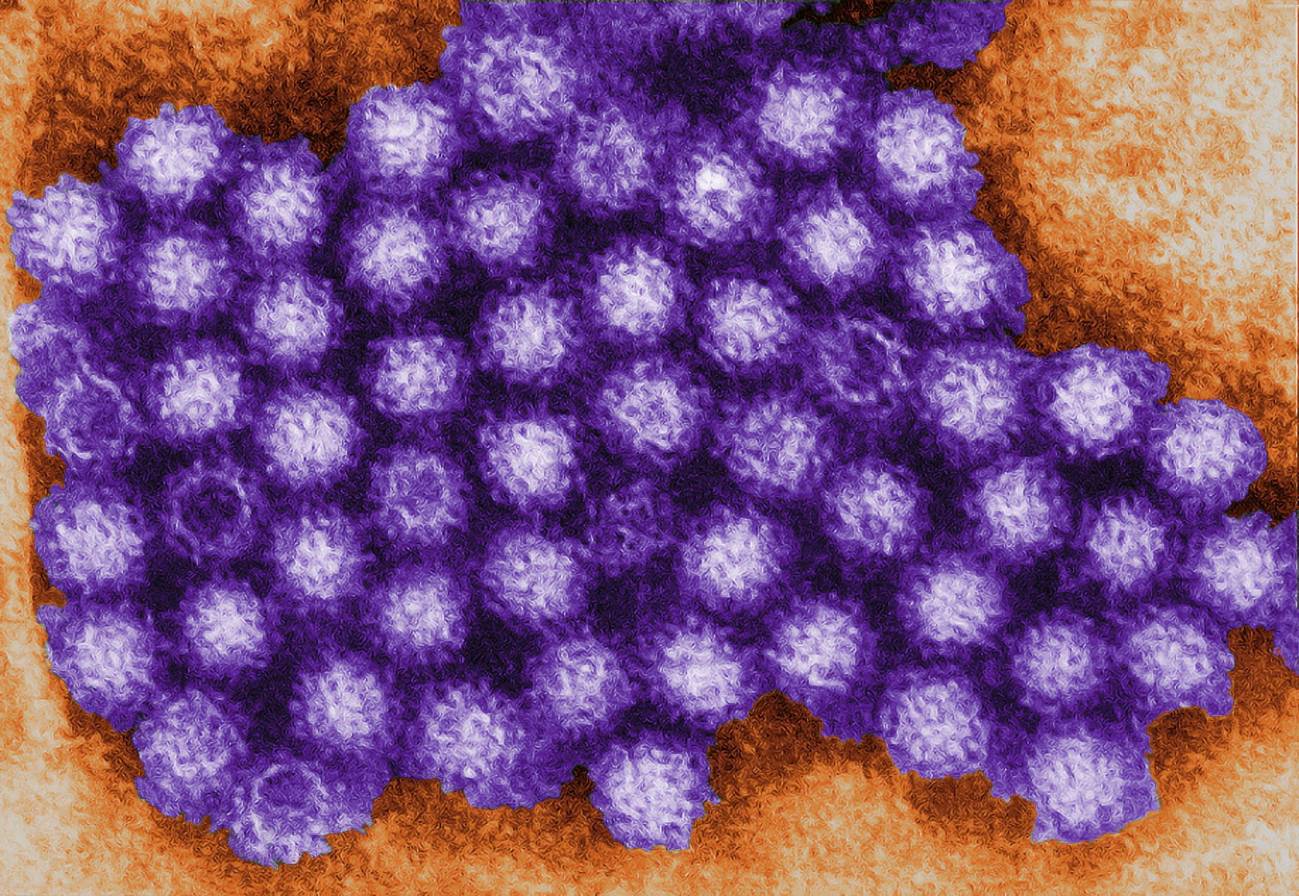 Así es el norovirus responsable del brote en el crucero de Burdeos