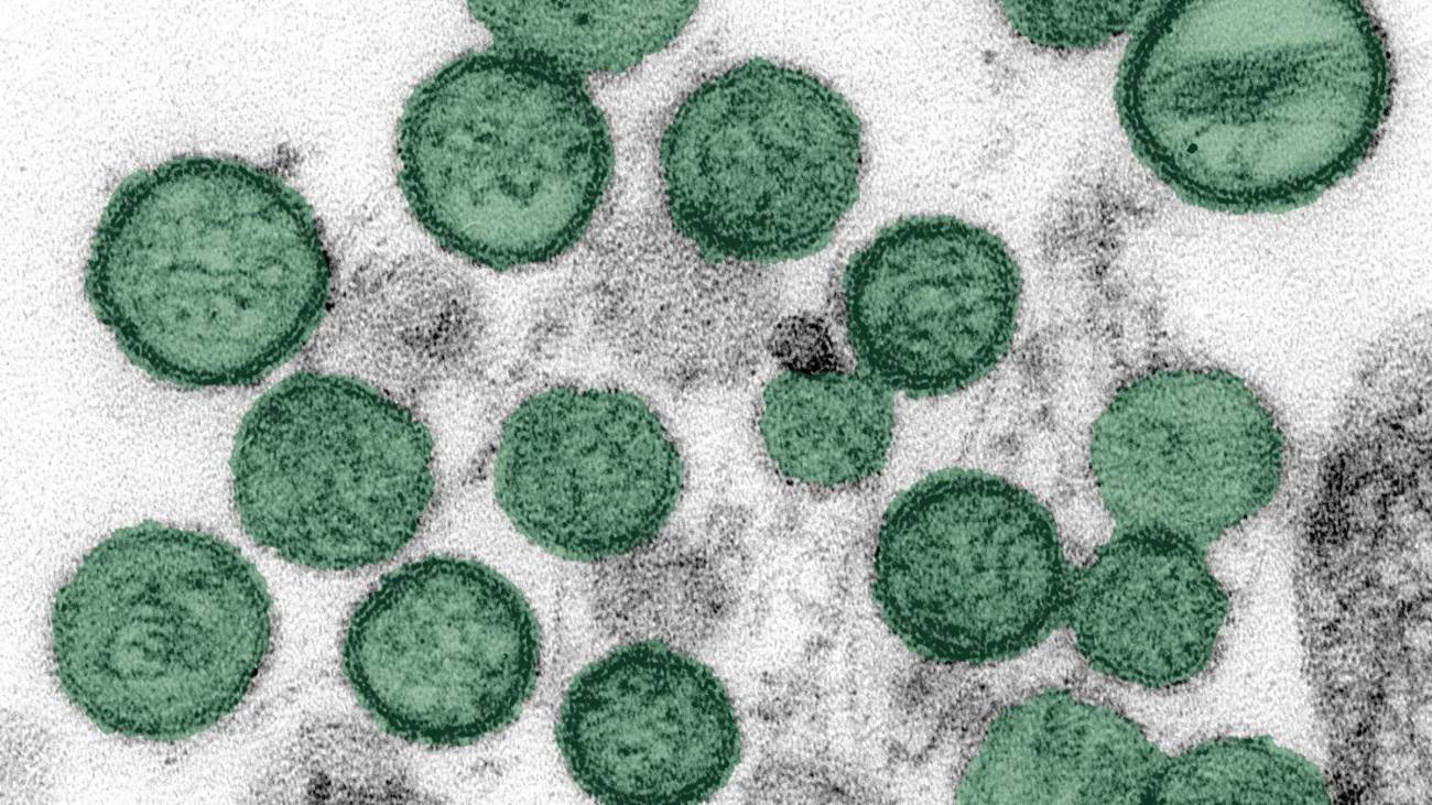 Así escapa el hantavirus al control del sistema inmunitario: ¿cómo puede evitarse?