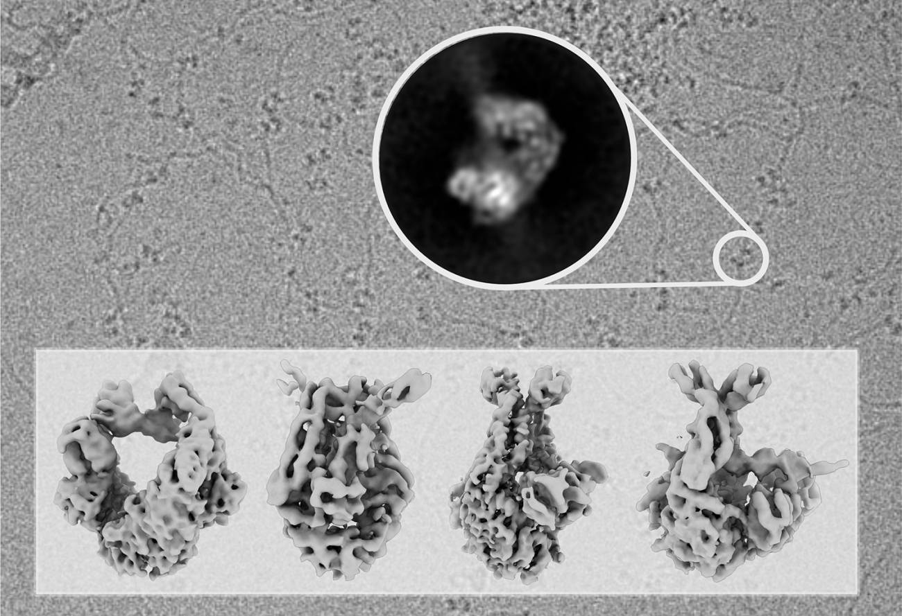 Moléculas de ADN decoradas con moléculas de la proteína MutS