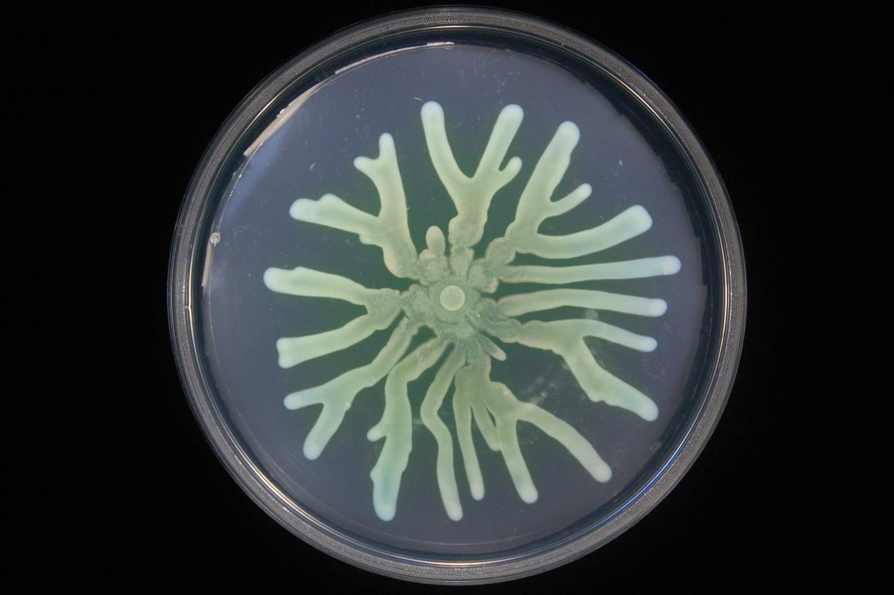 Así mejoran su supervivencia las bacterias resistentes a antibióticos