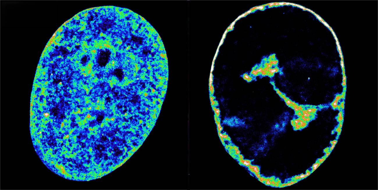 Así reorganiza el herpes labial el genoma humano para propagarse