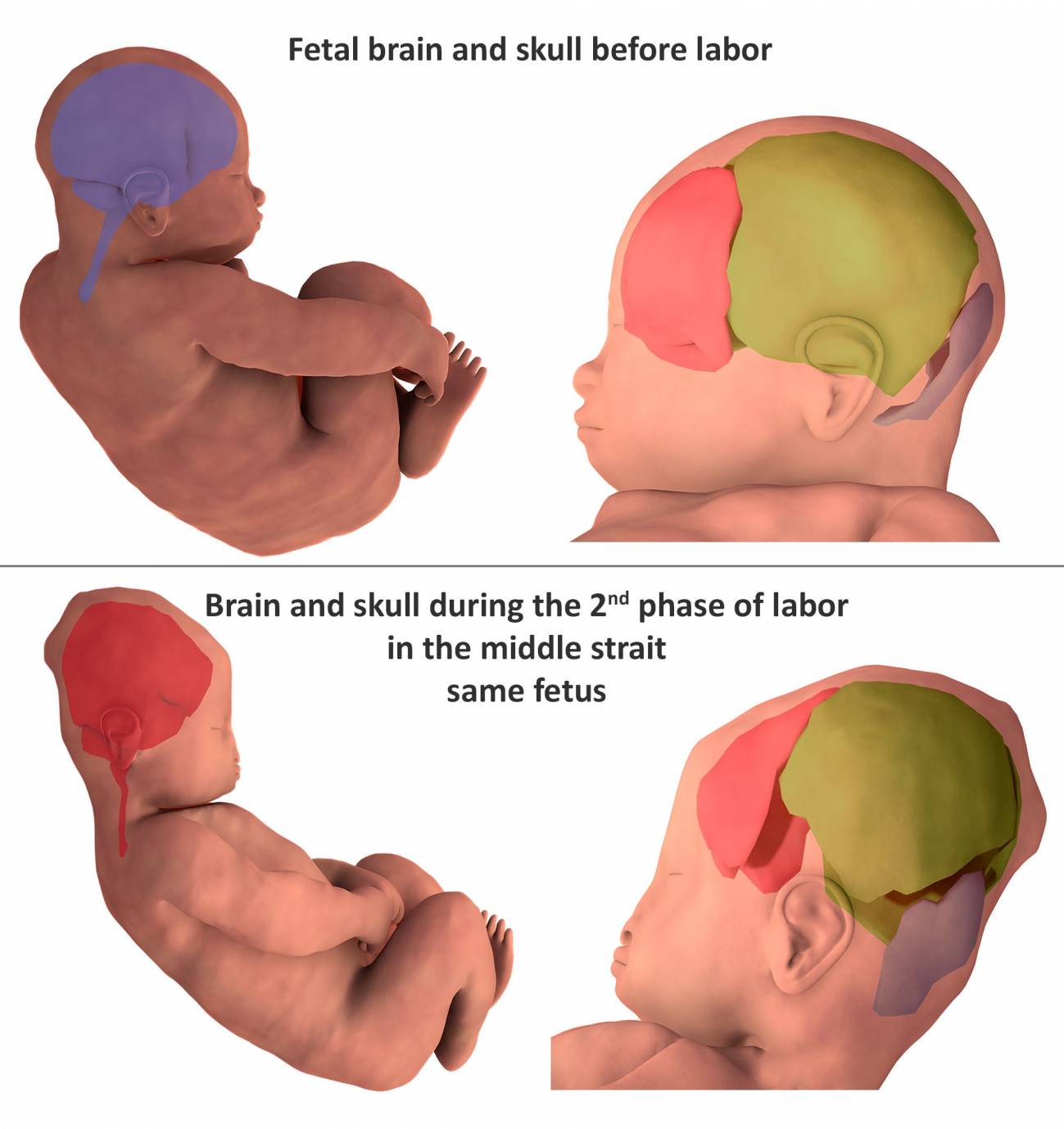 Así se deforma la cabeza de los bebés para facilitar el parto