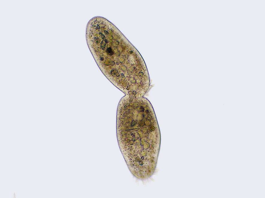 Imagen al microscopio de una ciliophora. / Wikipedia