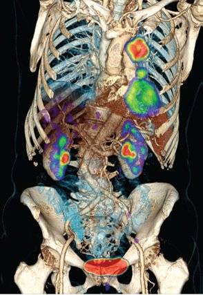 Imagen PET/CT