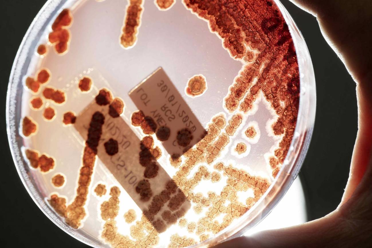 bacterias resistentes a antibióticos