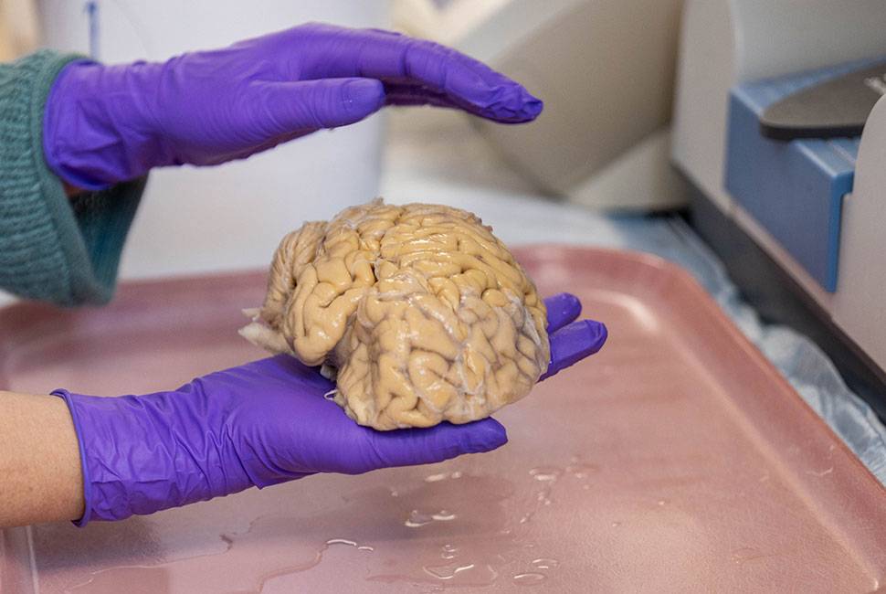 cerebro de superager