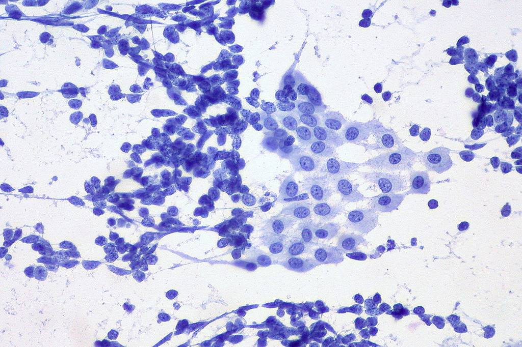 Investigadores del Instituto de Neurociencias de Castilla y León prueban en roedores la eficacia de compuestos químicos que actúan sobre los receptores del neurotransmisor