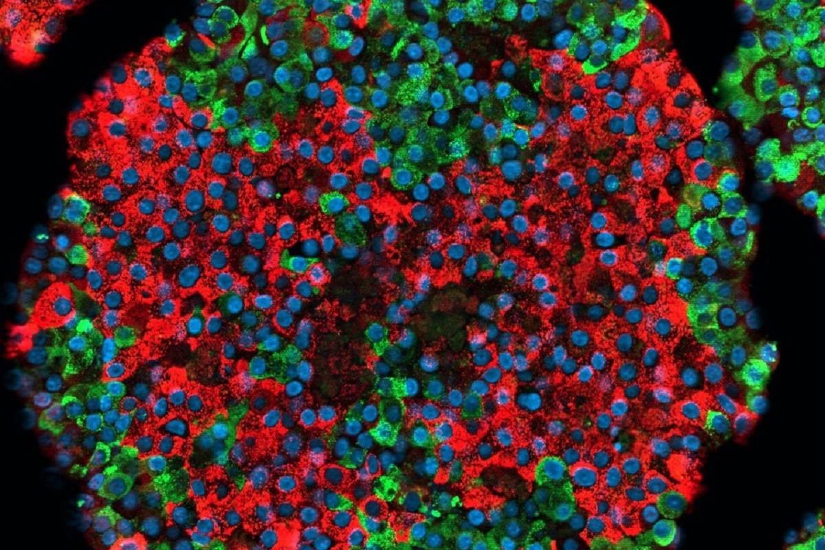 Crean por primera vez células beta pancreáticas funcionales a partir de células madre 