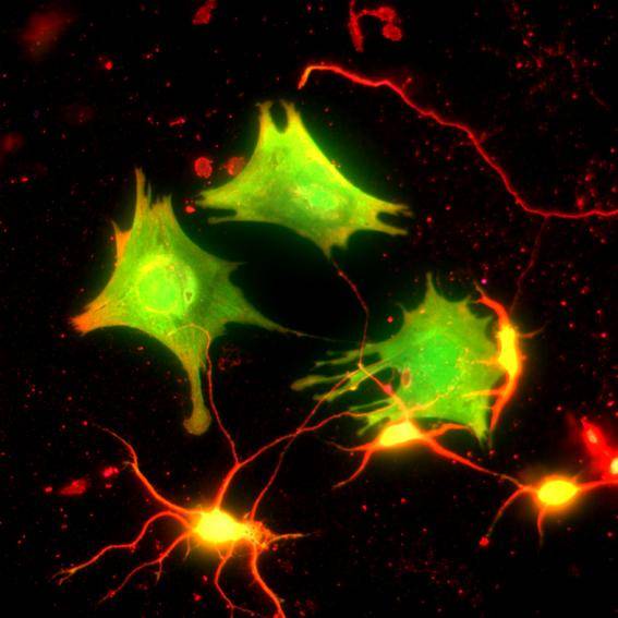 Crean un modelo más realista de representación neuronal aplicado a la toma de decisiones