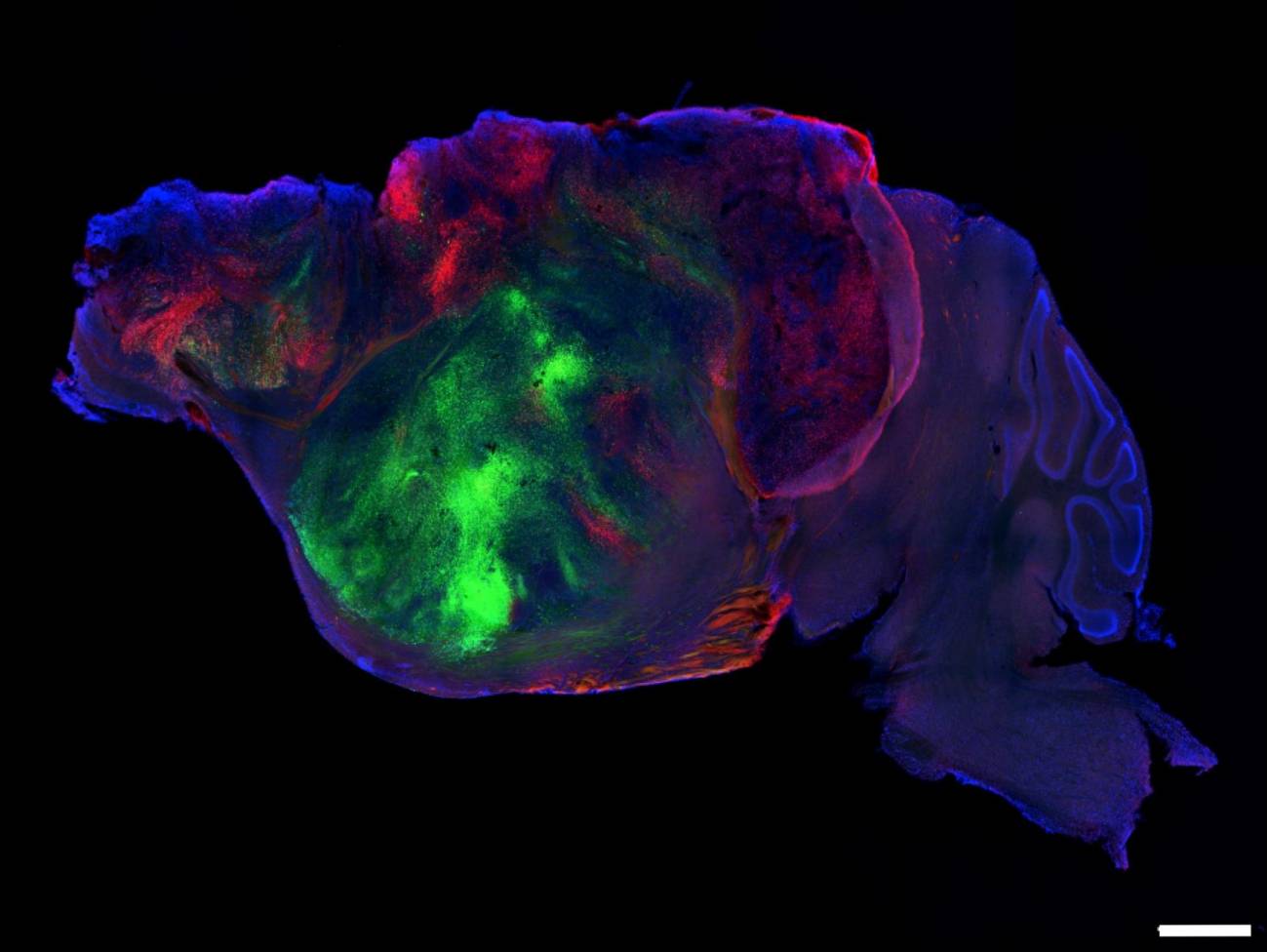 Cultivan tejido cerebral humano en modelos de ratón para el estudio de enfermedades