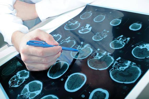 Investigadores de la Universidad de León han probado que el ácido 2OAA tiene efectos neuroprotectores en ratas