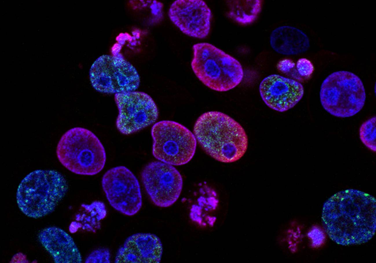 Desarrollan microdispositivos que distinguen las células tumorales de las sanas