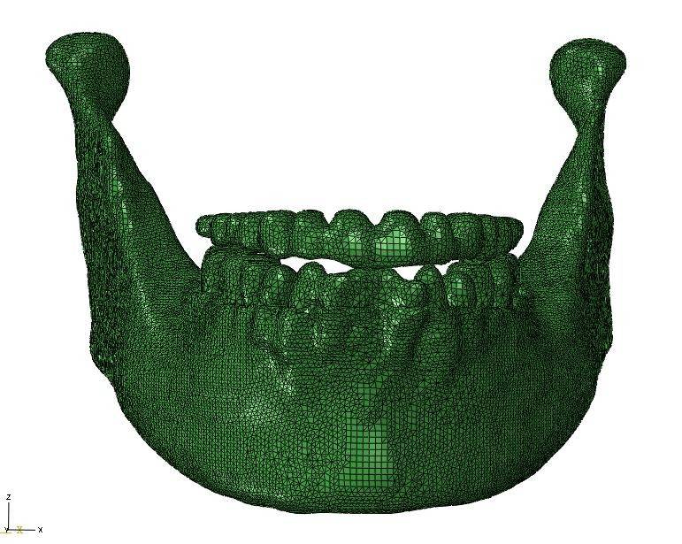 Desarrollan modelos biomecánicos para predecir el comportamiento de la mandíbula humana
