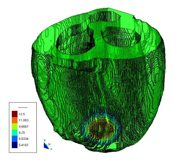 Desarrollan un corazón virtual para estudiar las causas de las arritmias cardiacas y mejorar su tratamiento