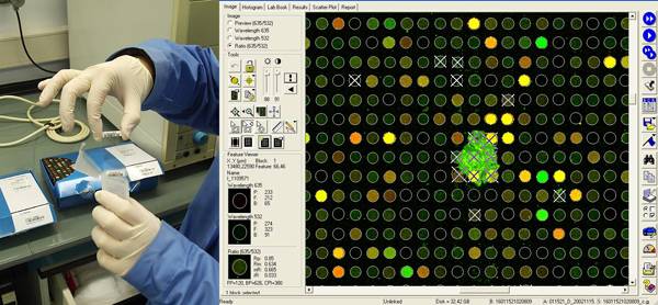 Desarrollan un panel de biomarcadores para el diagnóstico precoz del cáncer de colon