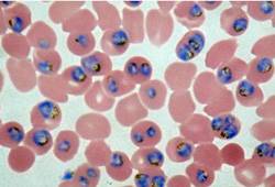 Plasmodium falciparum