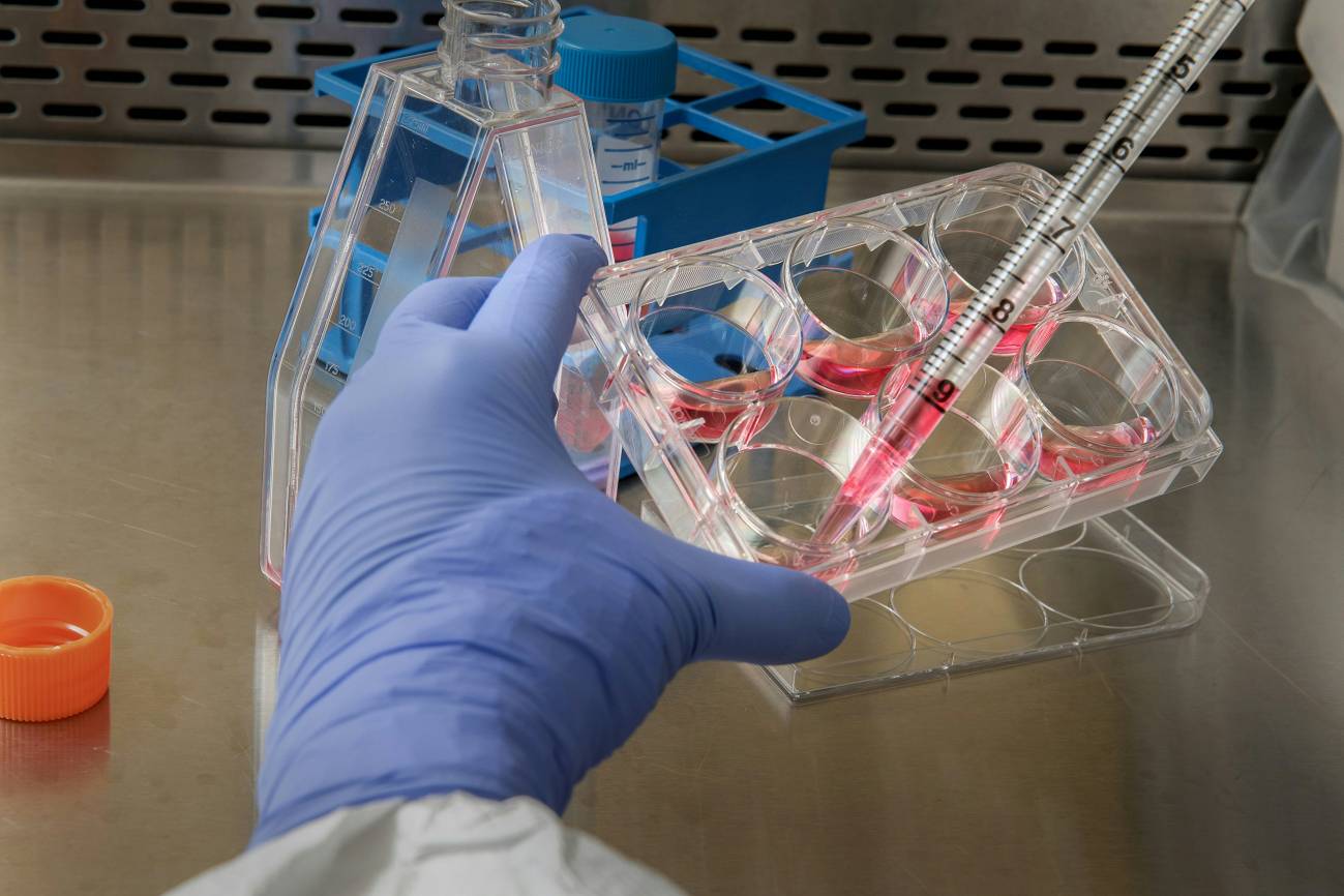 Desarrollan una terapia génica contra el sarcoma de Ewing, un tipo de cáncer infantil
