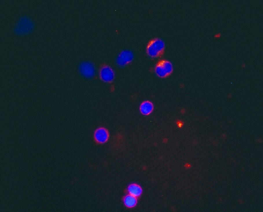 expresión de HCV-core