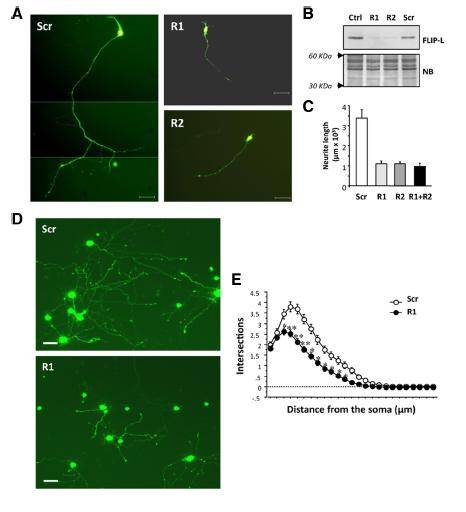 Descrita por primera vez una proteína clave para el desarrollo del sistema nervioso