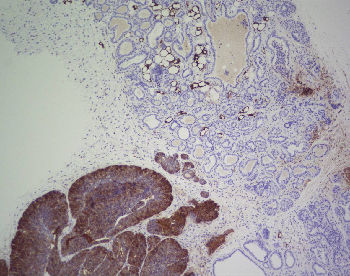 Imagen de inmunohistoquímica de FASN. / CNIO