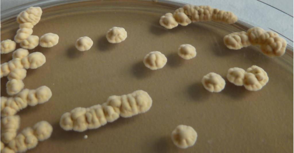 Vista al microscopio de uno de los actinomicetos hallados en el mar Cantábrico.