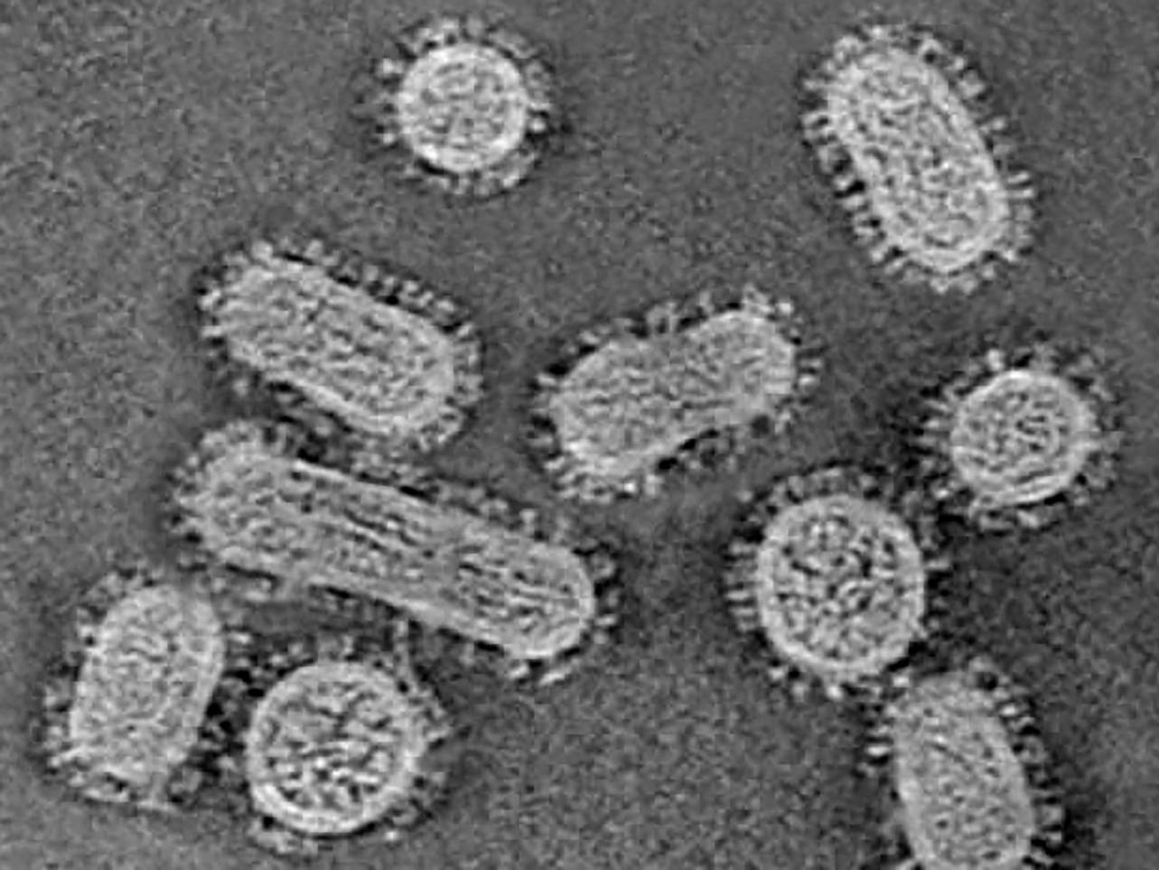Descubierto el mecanismo que hace que el virus de la gripe se multiplique de forma eficiente