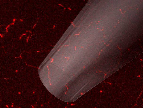 Descubierto el origen de las molestias de la enfermedad del ojo seco