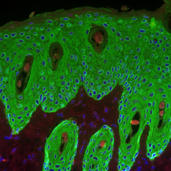 Descubierto un nuevo mecanismo molecular clave para la formación de la piel