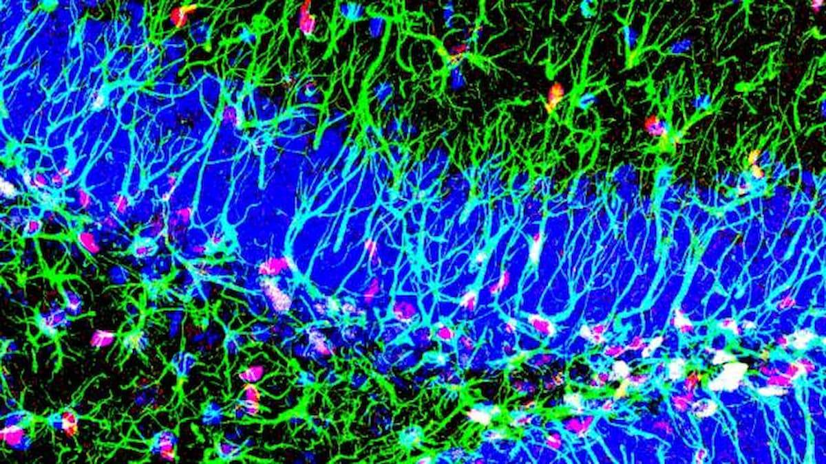 Muestra microscópica del hipocampo con presencia de células madre y la proteína Sox6. / Cristina Medina Menéndez