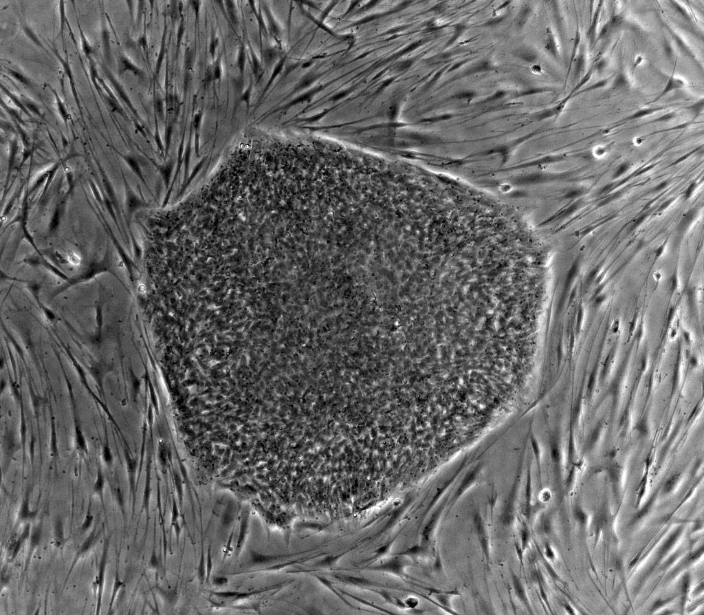 Descubierto un nuevo tipo de célula madre pluripotente para la medicina regenerativa