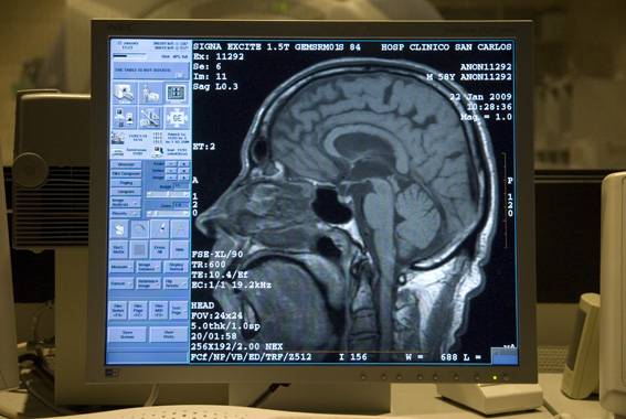 Descubren el papel de los receptores metabotrópicos en la formación de la memoria