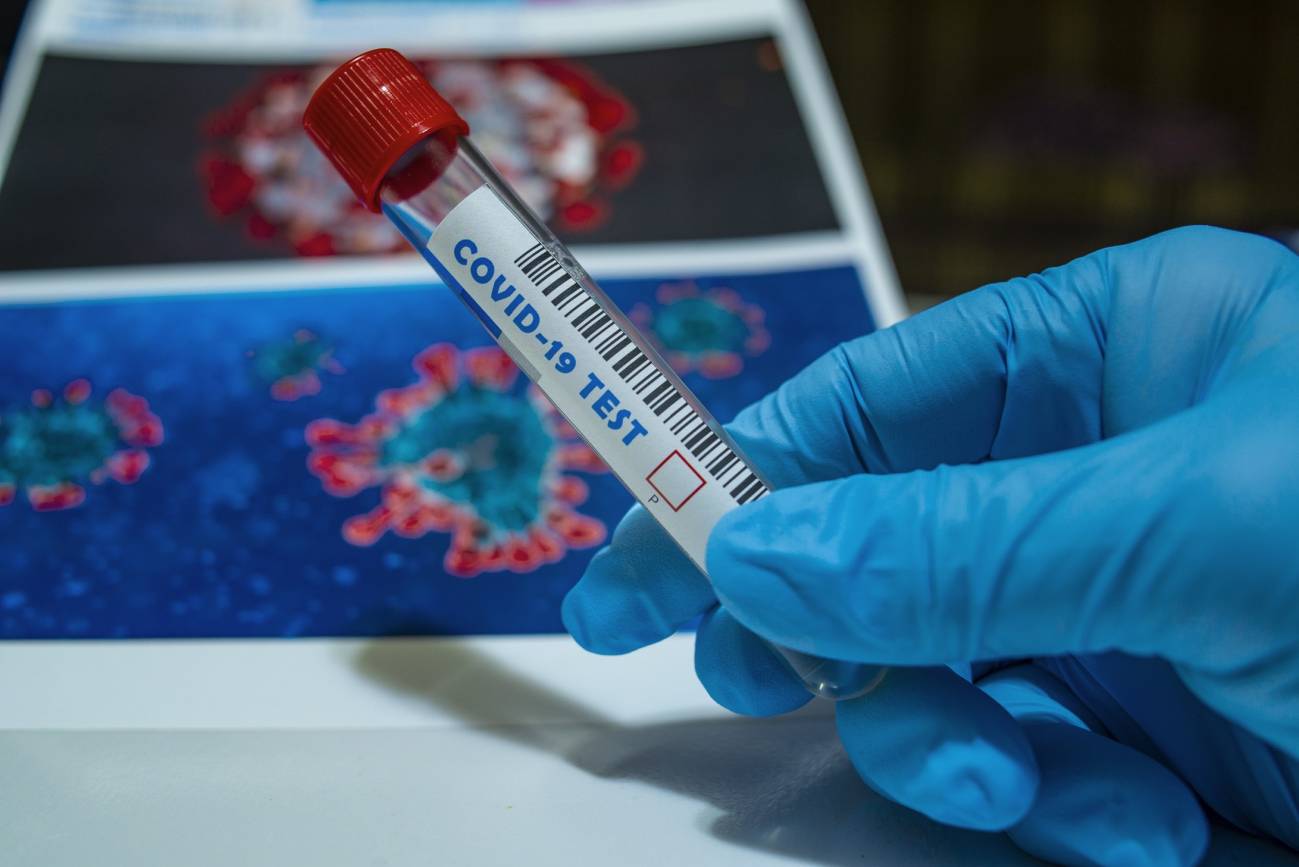Descubren fallos en las secuencias genéticas del coronavirus en la mayor base de datos mundial