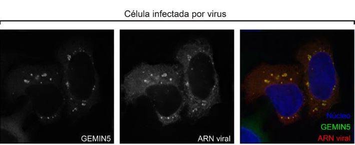 Descubren las proteínas de unión al ARN que causan la infección por virus