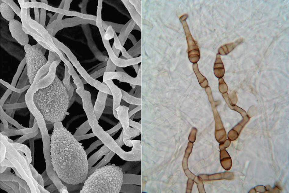 Descubren un principio activo para combatir las infecciones por hongos