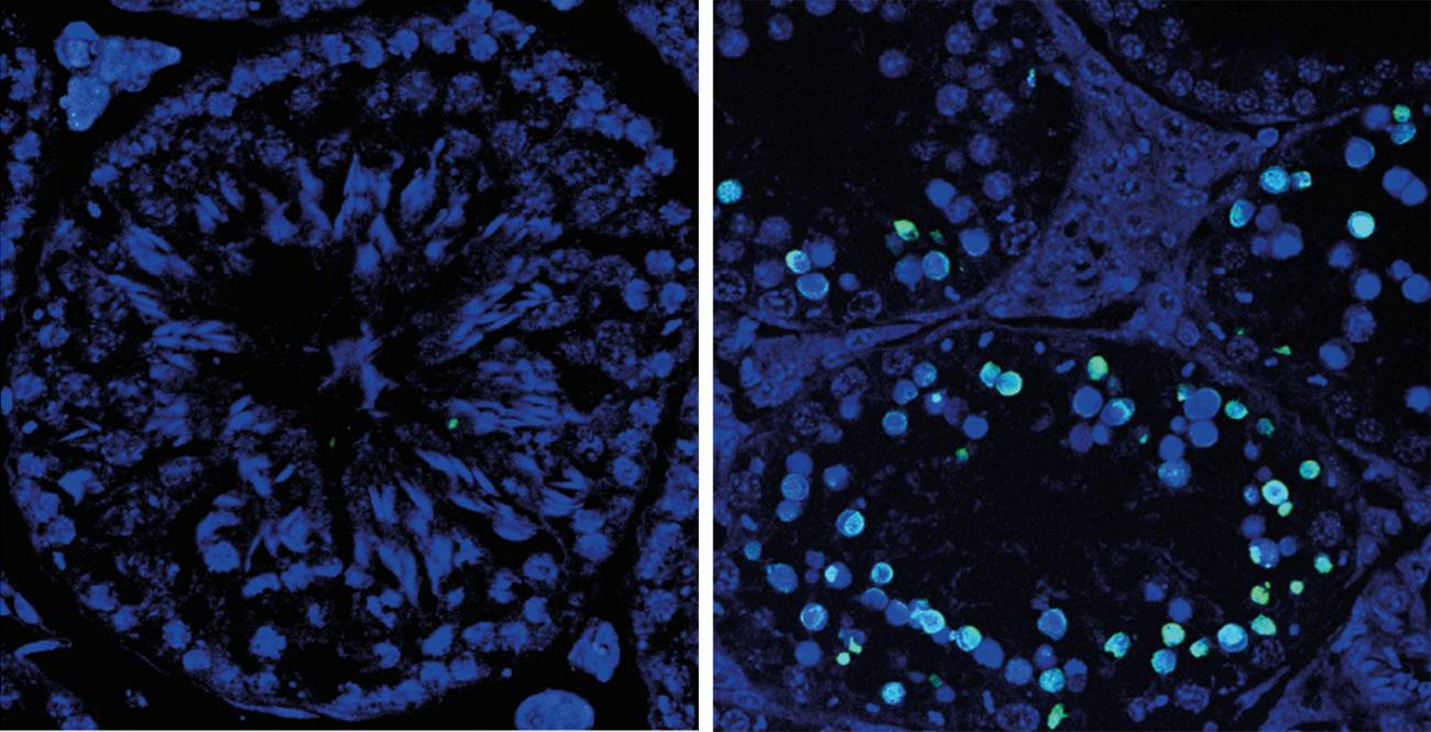 Descubren una proteína imprescindible para formar óvulos y espermatozoides