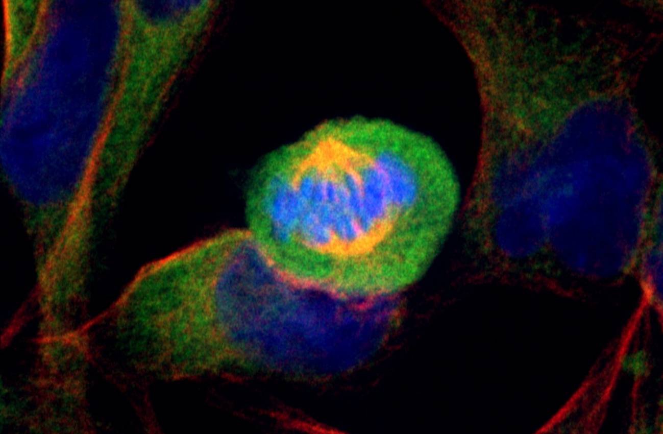 Células de cáncer de páncreas humano en división