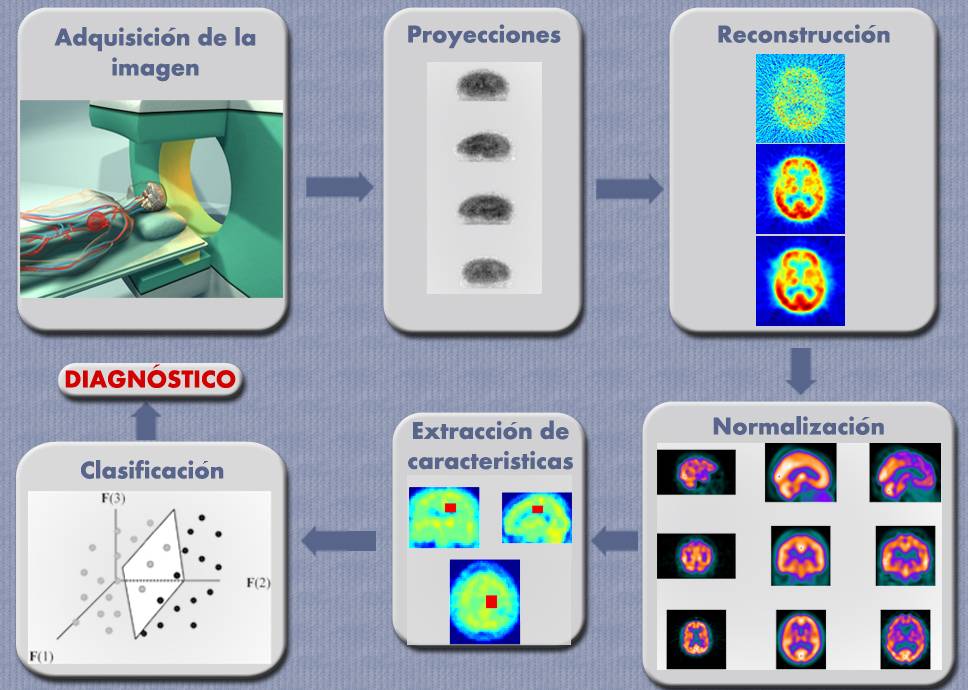 esquema