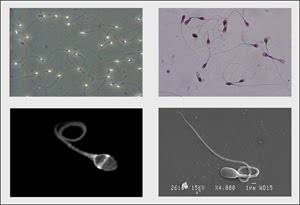 Imágenes de espermatozoides