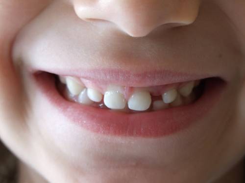 Doce millones de euros para la atención bucodental de niñas y niños