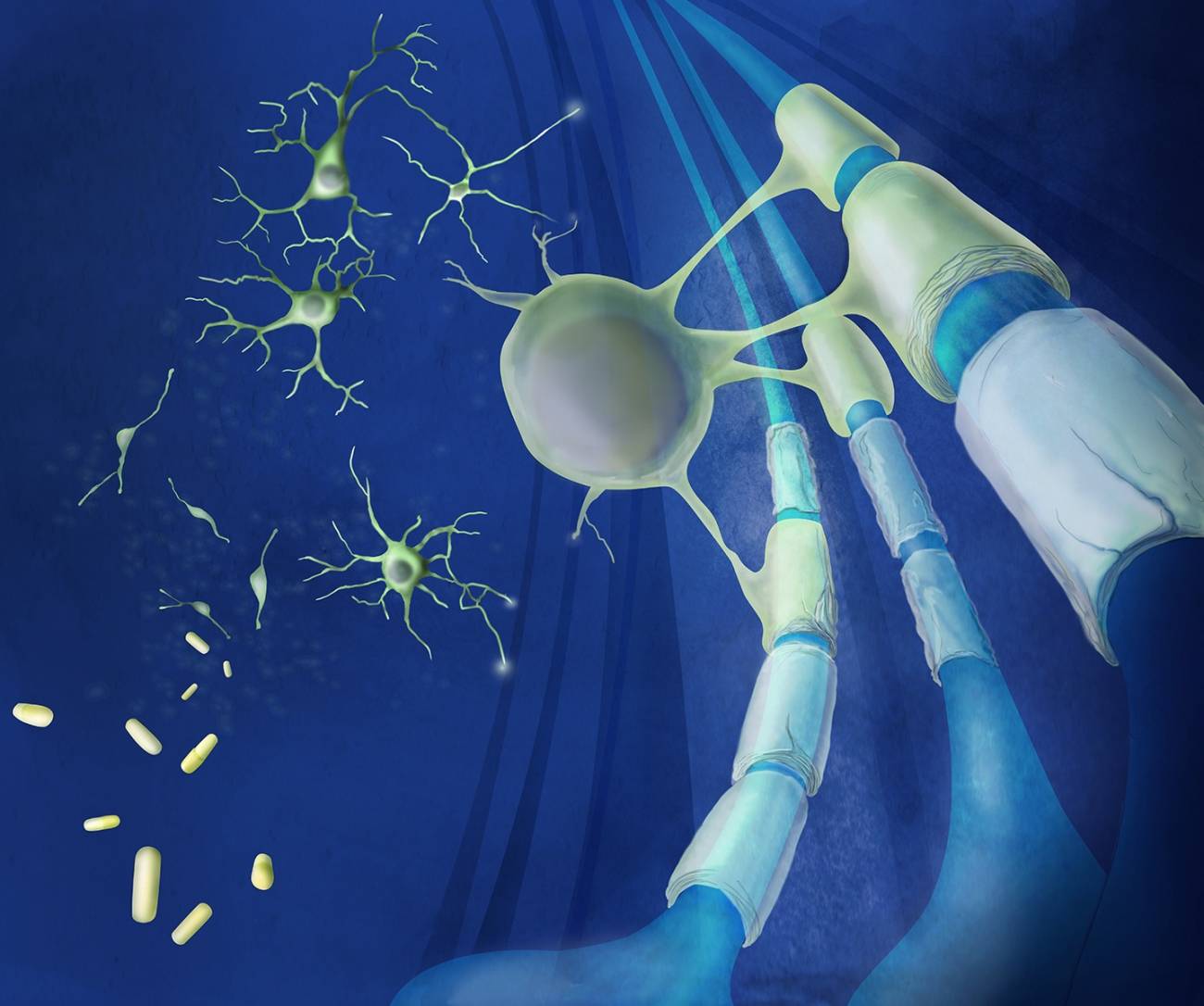 Dos fármacos cutáneos regeneran neuronas dañadas por esclerosis múltiple  