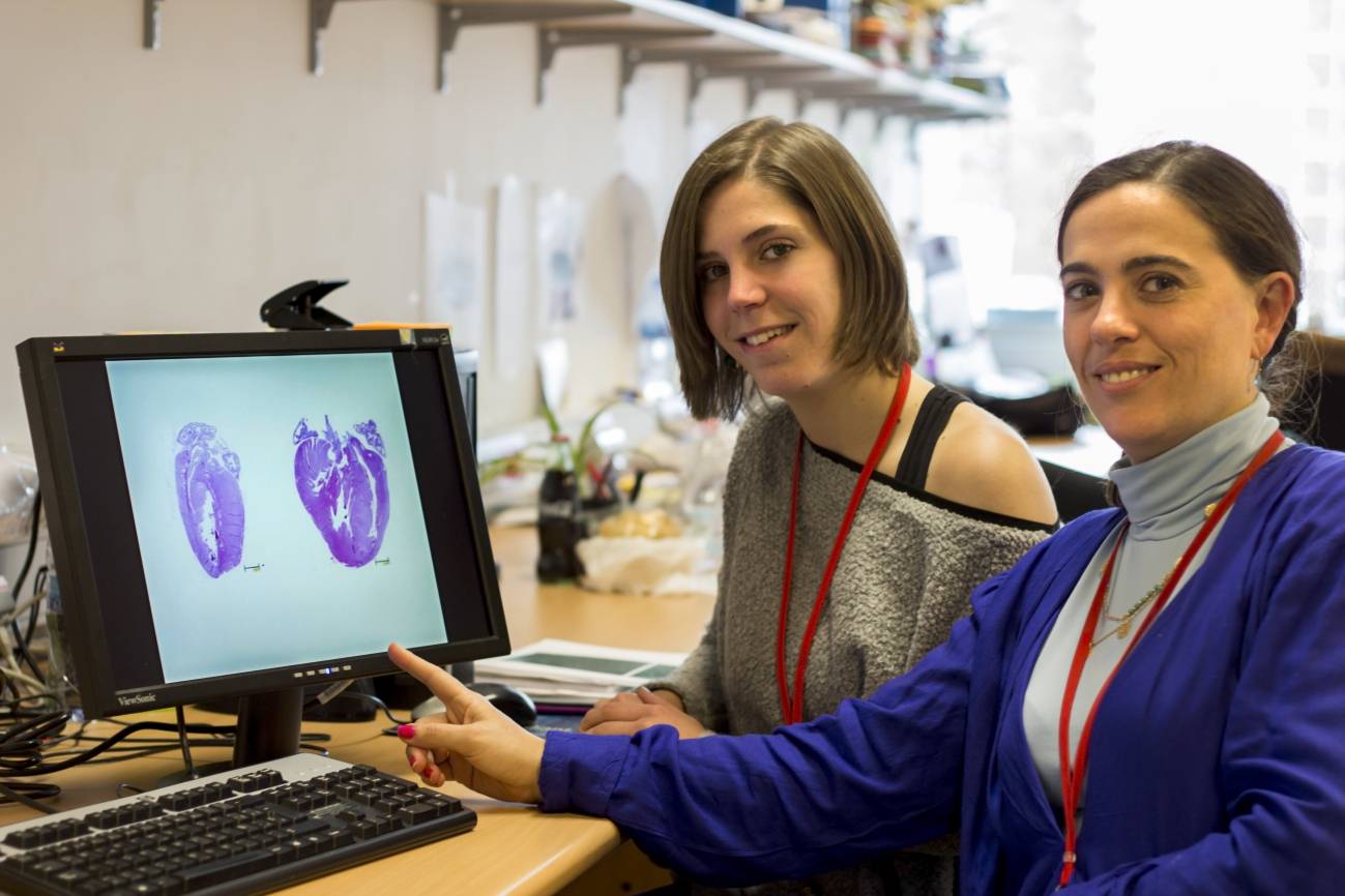 Dos proteínas controlan el crecimiento del corazón y su adaptación a la hipertensión arterial 