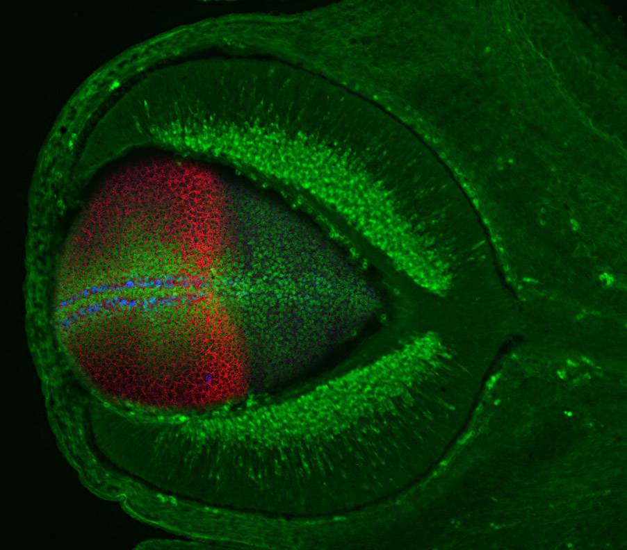 Dos proteínas que causan malformaciones oculares podrían estar relacionadas con el alzhéimer