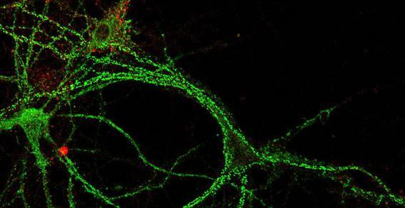 El colesterol cerebral es una pieza clave en el aprendizaje y la memoria