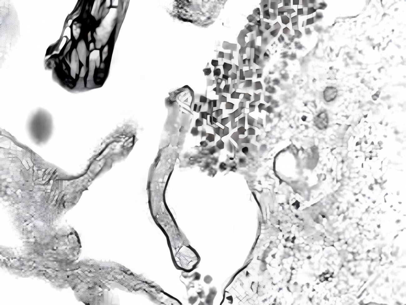 Partículas virales del dengue