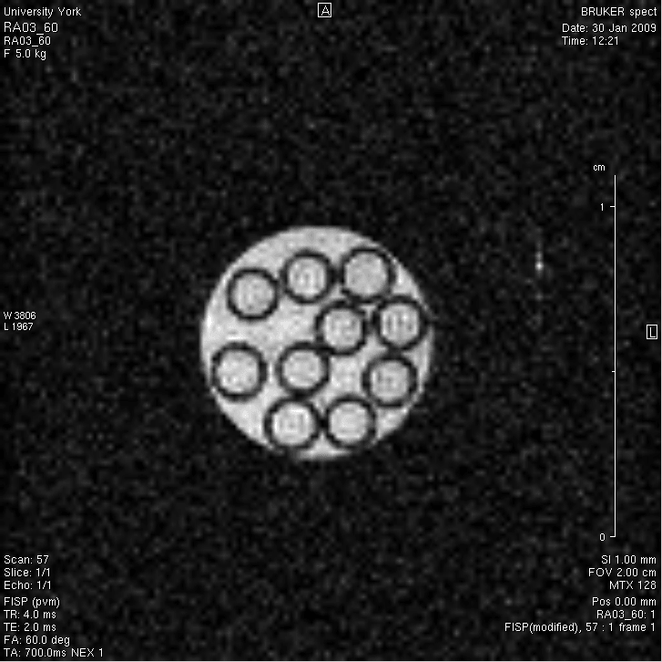 El diagnóstico médico mejora gracias a una nueva tecnología de resonancia magnética