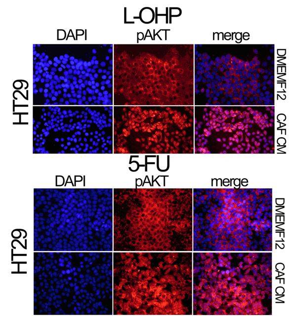 immunofluorescencia