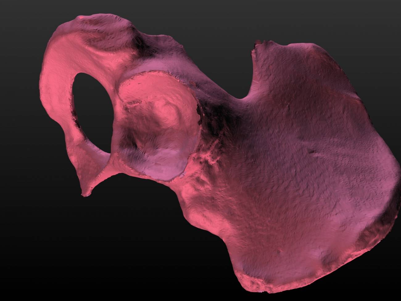 El escaneado láser 3D optimiza la cirugía ortopédica