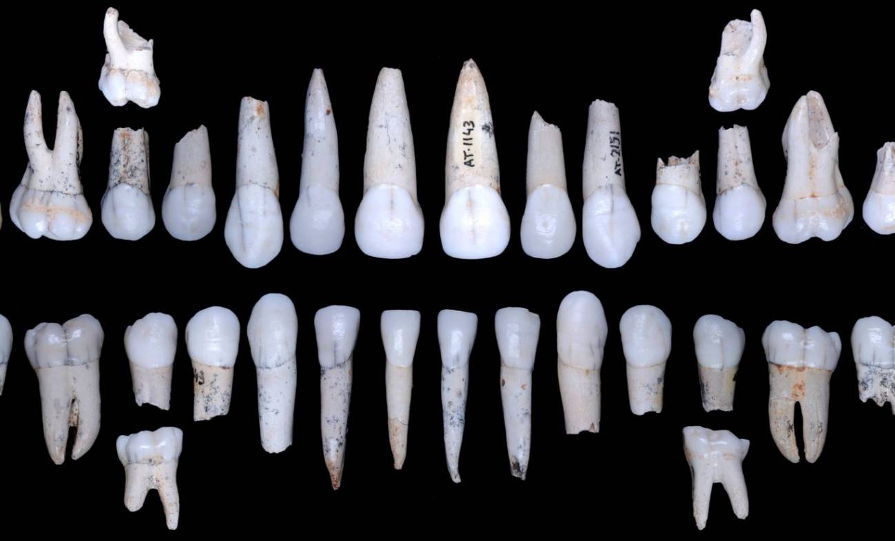 El esmalte de los homínidos de Atapuerca crecía más rápido que el de los humanos modernos